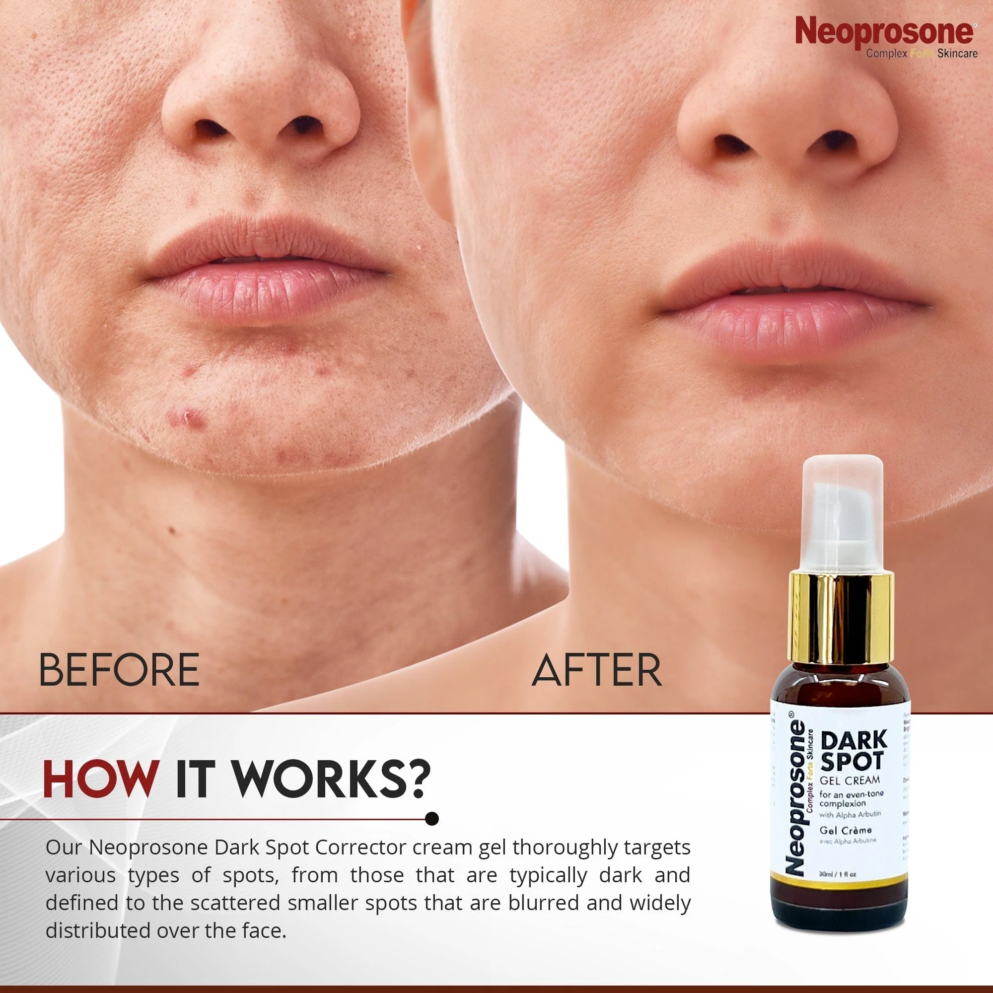 Neoprosone Dark Spot Gel Cream With Alpha Arbutin 30ml / 1 fl oz - Image 5
